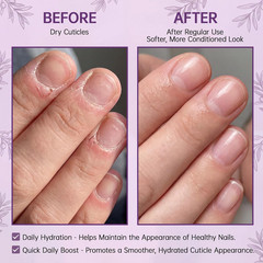 Cuticle Oil Pen for Dry Cracked Cuticles, Hydrating Nail Moisturizer with Jojoba
