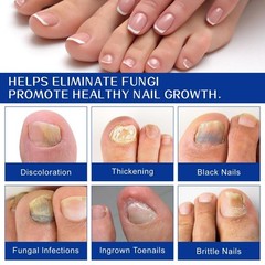 Renewal Fungal Nail Patches Patch Overnight Nail Repair for Nail Fungus Damage