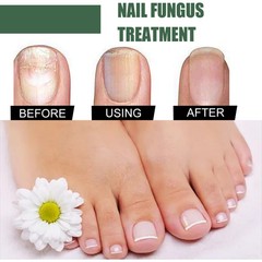 Nail Repair Liquid 30ml, Thick & Weak Nail Treatment, Moisturizing Care