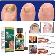 Nozti Anti Paronychia Relief Oil, 10ml, Natural Nail Treatment for Pain Relief