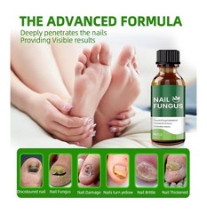 Nail Fungus Treatment – Herbal Formula Repair & Prevent 30ML