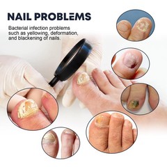 Nail Care Spray Nail Repair Strengthening Treatment Spray for Brittle Nails