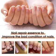 Nail Care Pen 1-6X The Original Pen Health Routin Nail Fungus