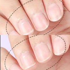 Nail Strengthener Fingernail Strengthener Chip-resistant Cuticle-