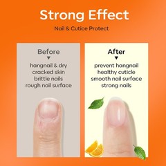 Quick-Dry 15ml Nail Growth Oil with Precision Brush for Flawless Application