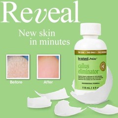 Prolinc Callus Eliminator Original 4 oz (Pack of 2 Bottles)