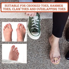 Nuanchu 6 Pieces Double Hammer Toe Straightener Budin One Size, Beige