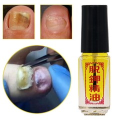 Nail Removal Essential Oil Anti-Fungus Oil Removal of Onychomycosis Paronychia