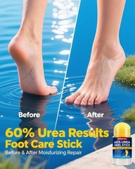 Urea Cream 60% with 2% Salicylic Acid, Foot 60 1.41 Ounce (Pack of 1)