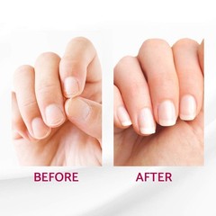 IBD Reconstrux Nail Repair Treatment – 0.12 Fl Oz (Pack of 1), Clear