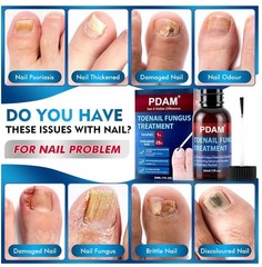 PDAM Toenail Fungus Treatment Liquid w/ Undecylenic Acid & Tolnaftate 30ml