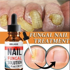 Nail Repair Liquid for Fungal Nails, Toenail Treatment ; Nail Strengthening