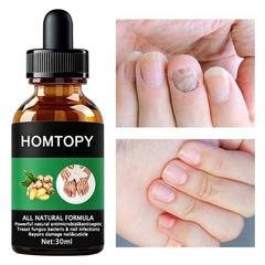 Toe Nail Care Liquid 50ml Fast Absorption Lightweight Gentle for All Skin Types