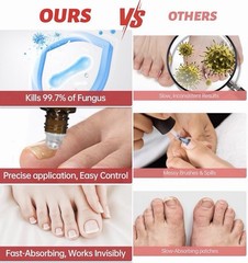 QQE Fungal Nail Treatment 7 Days+ Cream 1% Tolnaftate 0.51 fl oz / 15 ml