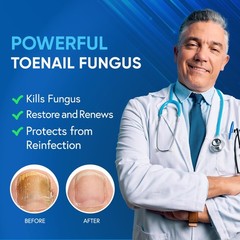 Toenail Fungus Treatment Extra Strength with 25% 0.5 Fl Oz (Pack of 2), White