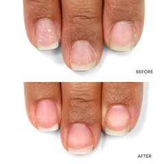 2pack LONDONTOWN kur Nail Probiotic Instant Boost Nail Mask for Weak Thin Nails
