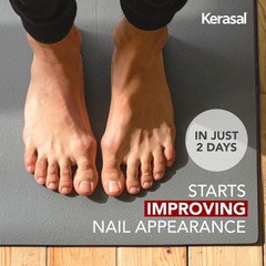 Kerasal Nail Renewal, 0.33 Fl Oz (Pack of 1), Renewal