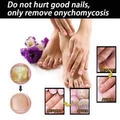 Nail Care Liquid Daily Cleaning Hand Foot Moisturizing Nail Fungus Treatment