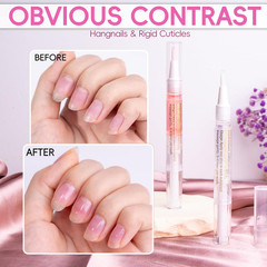 2PCS Cuticle Oil Pen for Nails,Nail Oil Pen for Nail Care,Cuticle Oil for Nails
