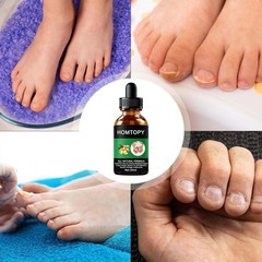 Toe Nail Care Liquid 50ml Fast Absorption Lightweight Gentle for All Skin Types