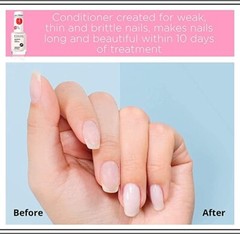 Maximum Nail Growth Quickener (12 ml)