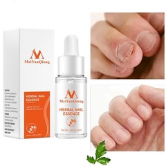 Herbal Toenail Repair Essence Effective Nail Whitening For Women Men P2Y2 _30ml.