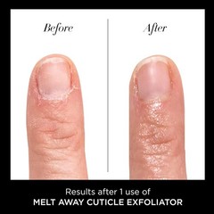 Cuticle Remover Liquid, Melt Away – Cuticle Oil Exfoliator & Softener Gently …