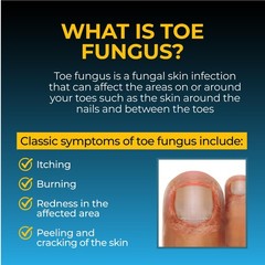 Fungi-Nail Pen Applicator Anti-Fungal Solution, 0.1 Fl Oz (Pack of 1),