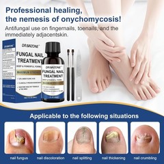 Toenail Fungus Treatment Extra Strength 2 Fl Oz (Pack of 1), blue – 2PACK