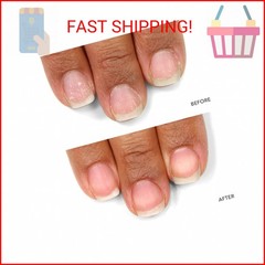 LONDONTOWN kur Nail Probiotic Instant Boost, Nail Care Mask For Weak/Thin Nails,