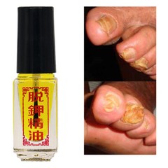 Nail Removal Essential Oil Anti-Fungus Oil Removal of Onychomycosis Paronychia