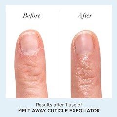 Melt Away Cuticle Remover Oil – Effortless Nail Care for Healthy Beautiful Nails