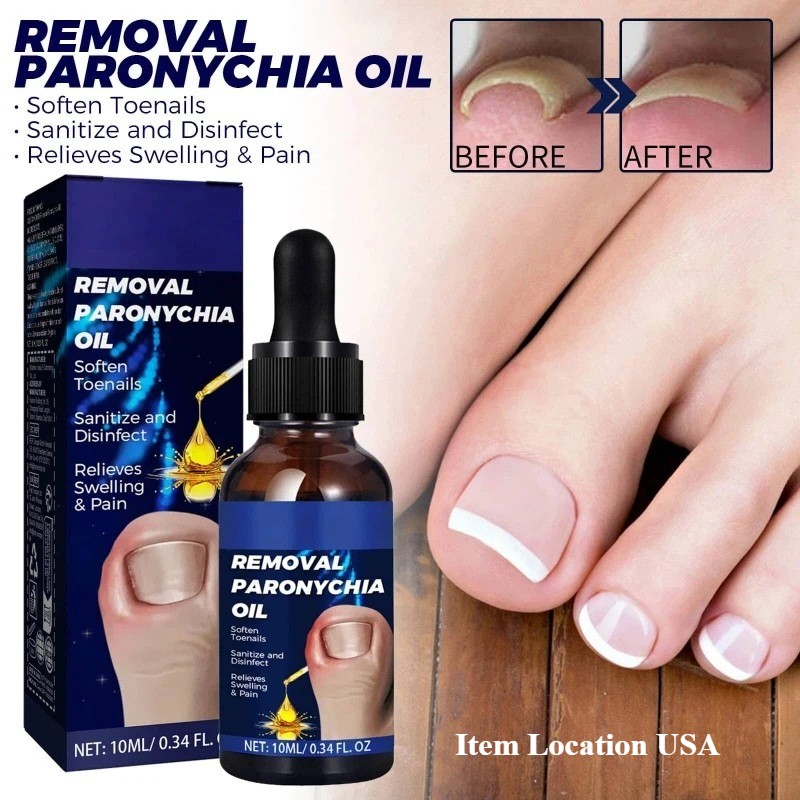 10ml Anti Fungal Nail Care Products Anti Paronychia Relief Nature Nail Care Oil