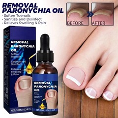 Anti Fungal Nail Care Products Anti Paronychia Relief Healthy Nail Care Oil 10ml