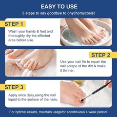 Toenail Fungus Treatment Extra Strength with 25% Undecylenic Acid, Ingrown…