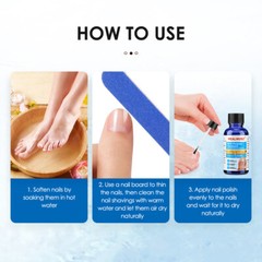 30ml Nail Repair Oil Fungal Nail Treatment Liquid Remove Toe Nail Fungus Essence