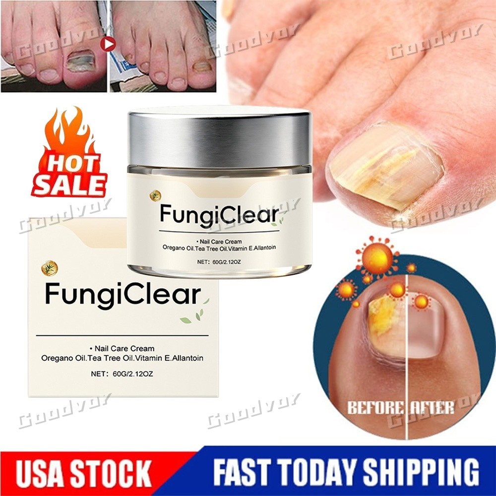 FungiClear Phrena Nail Care Cream With Tea Tree Oil, Oregano Oil, Vitamin E ~US