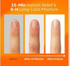 modelones Cuticle Oil Pen | Rose |Nail Growth and Strength