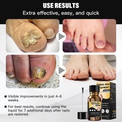 Toenail Fungus Treatment,Foot 1 Fl Oz (Pack of 1), Gold-on-Black