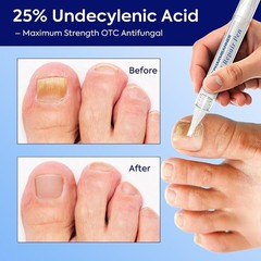 Extra Strength Nail Care Solution: Natural Formula – Complete Nail Restoratio…