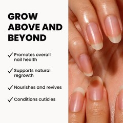 LONDONTOWN kur Restorative Nail Cream, 1 Fl Oz 1 Ounce (Pack of 1), White