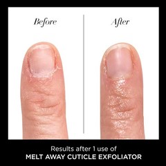 Cuticle Exfoliator Liquid – Fast-Acting Formula
