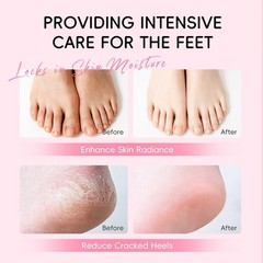 New Cover Cracked Heel Repair Stick, JAPAN SAKURA 1.41 Fl Oz (Pack of 1)