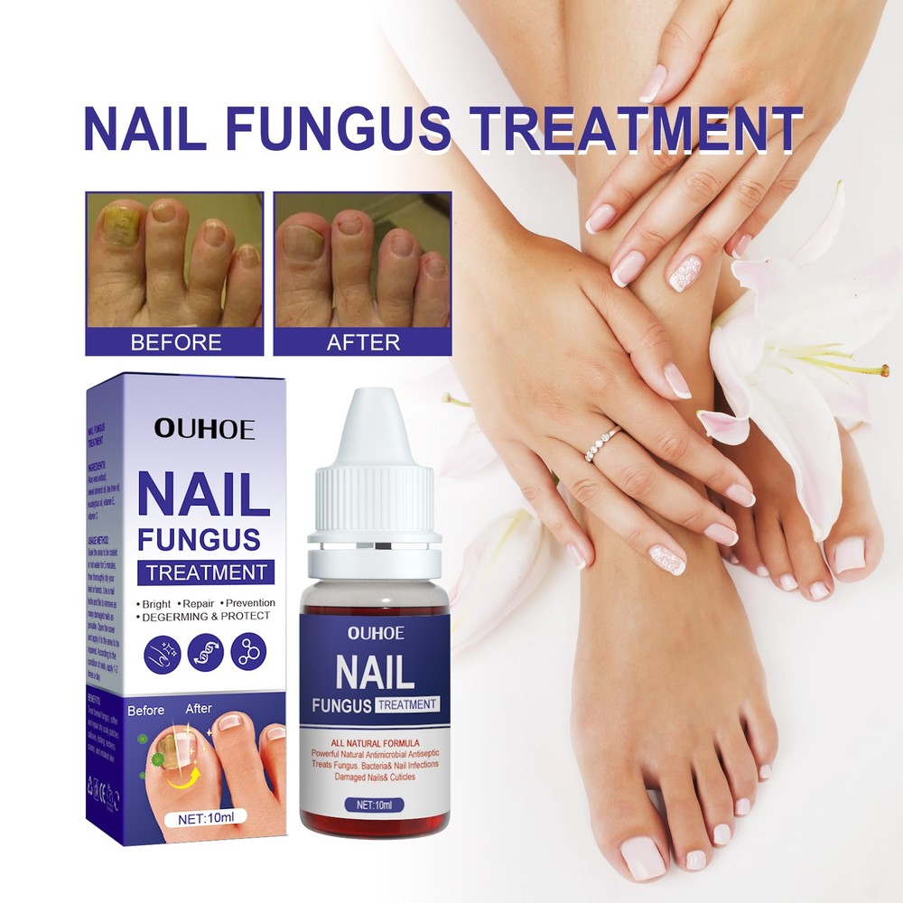 Nail Repair Lotion, Repair Thickening Nail Inlay Gray Nail Shine Soft Nail Care