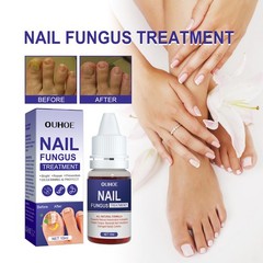 Nail Repair Lotion, Repair Thickening Nail Inlay Gray Nail Shine Soft Nail Care