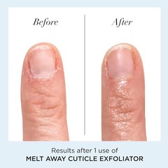 Melt Away Cuticle Remover – Gentle Nail Softener for Spa-like Home Grooming