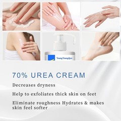 YOUNGYOUNGLOVE 10.1 Oz – Urea Cream 70% Ounce (Pack of 1), Dark Blue