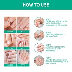 Nail Repair Serum Strengthening Nail Care Solution Nourishing Cuticle Oil