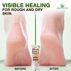 Miracle Foot Repair Cream, (1 oz / 3 Pack) 1 Ounce (Pack of 3), Pack 3