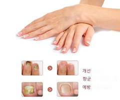 KORELAN Anti-Fungal Nail Repair Treatment Essence 20 ml Recuperative in 7 Days